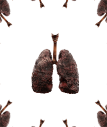 Image: Jean-Jacques Cassiman talks about his fight against cancer